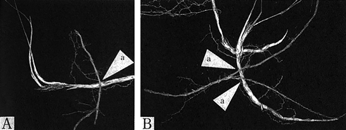 ［Fig. 1. A,B.］ チガヤに貫通されたドクダミの地下茎 (a). Rhizome of Houttuynia cordata pierced by Imperata cylindrica (a).